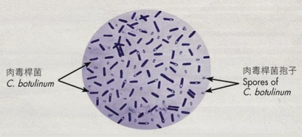 明明 100℃ 就能沸腾，灭菌为什么要 121℃？