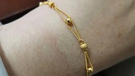 为什么金属过敏的人，只对金子不过敏？