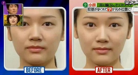 为何明星喜欢在耳朵上绑皮筋？