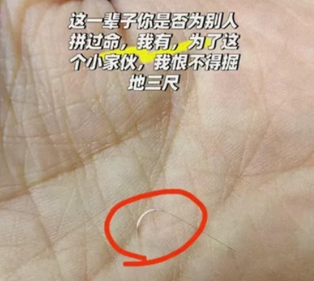 为什么手术中护士最怕听到主刀医生说 10-0 的针掉了？