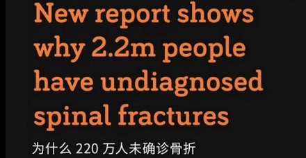为啥英国人冬天断脚的特别多，夏天断手的特别多？