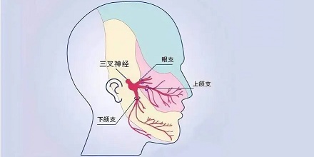 哪一种痛号称「天下第一痛」？